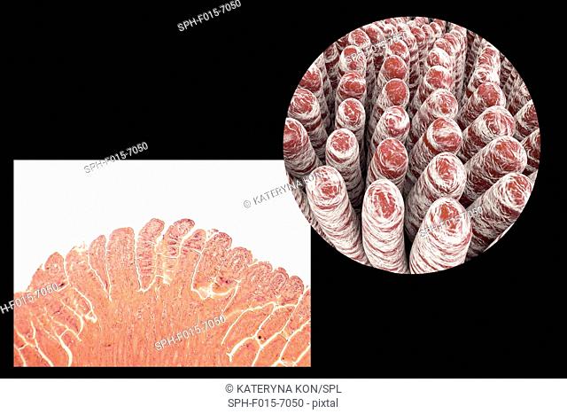 Intestinal villi, light micrograph and 3D computer illustration. Villi are finger-like projections that greatly increase the intestinal surface area for the...