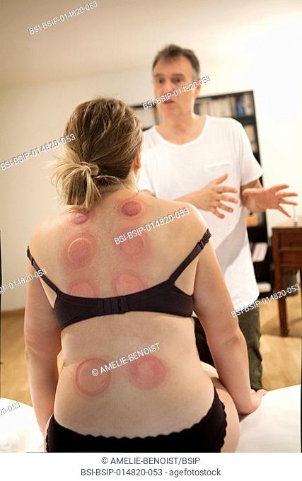 Reportage on a therapist who specialises in traditional Chinese medicine. Applying cupping-glasses massages connective tissue and improves vascularisation in...