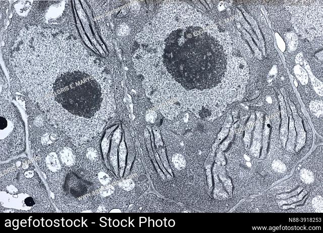 Electron microscopy of a vegetal cell showing chloroplast, nucleus, nucleole and cell walls