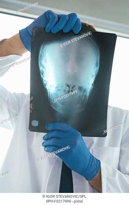 Doctor examining X-ray of the skull