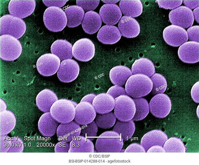 Under a very high magnification of 20, 000x, this scanning electron micrograph (SEM) shows a strain of Staphylococcus aureus bacteria taken from a vancomycin...