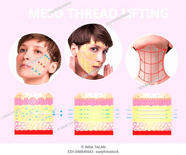 Meso thread Lift. Young female with clean fresh skin. Beautiful woman. face and neck. Lifting by threads concept. Collage