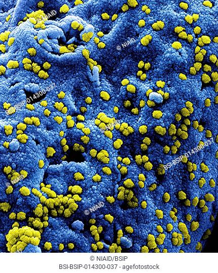 Colorized scanning electron micrograph of Middle Eastern Respiratory Syndrome virus particles attached to the surface of an infected VERO E6 cell