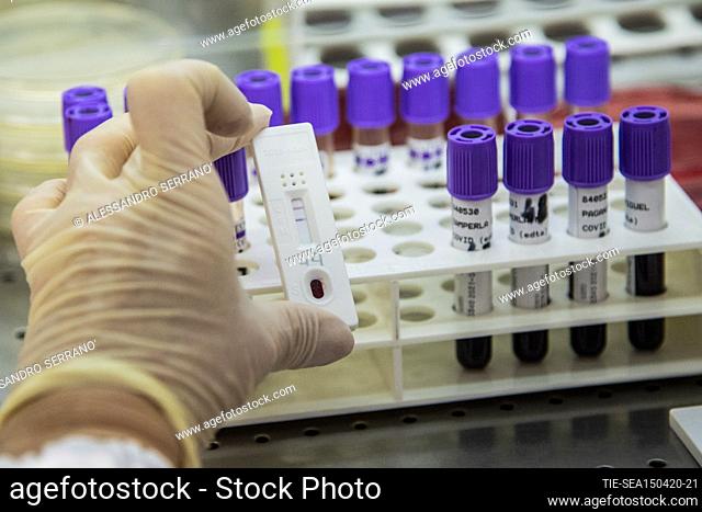 Diagnostic laboratory for the evaluation of tests, test number 44 is positive in the presence of antibodies. The private medical laboratory LabAurelia begins...