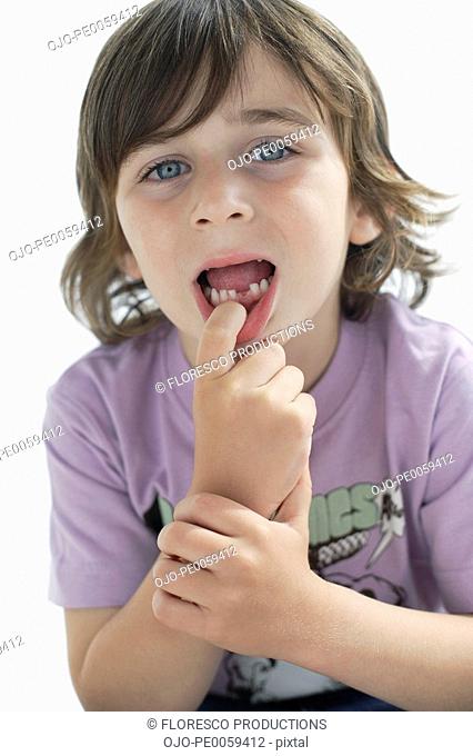 Boy showing missing tooth