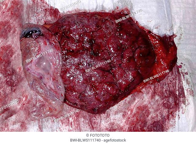 human placenta