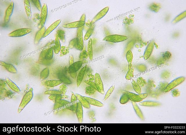 Euglena flagellate protozoans, light micrograph