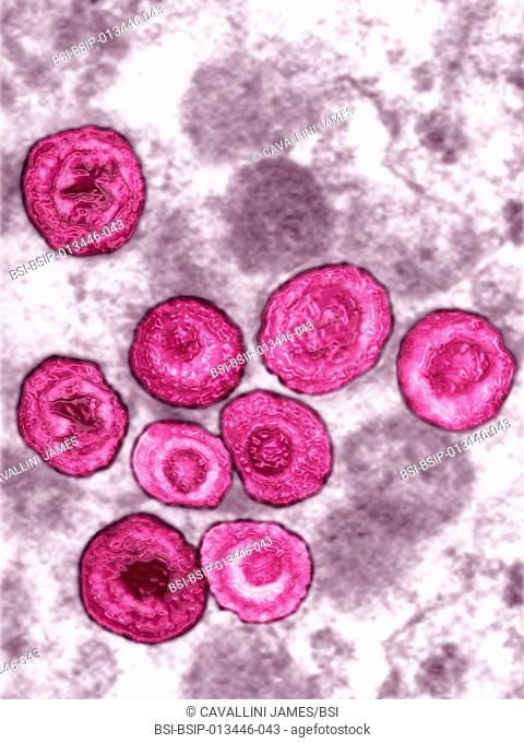 Cytomegalovirus (human herpesvirus type 5, HHV-5). It causes a dangerous mononucleosis syndrome particularly in immunodeprived individuals