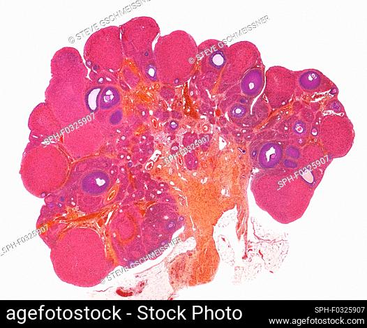 Ovary. Light micrograph (LM) of a section through the whole ovary. The cortex (outer region) contains numerous corpora lutea (pink) and follicles (purple) at...