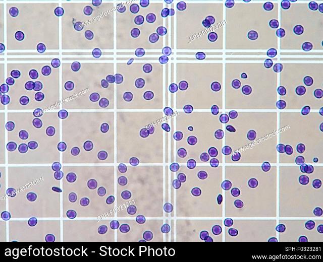 Blood cells in counting chamber