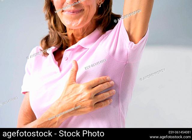 Woman With Hyperhidrosis Sweating Very Badly Under Armpit