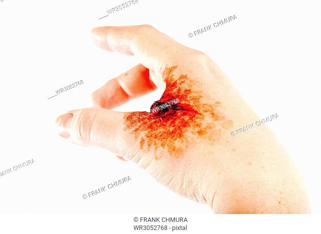 Artificial Blood Wound on Human Hand - Isolated on White