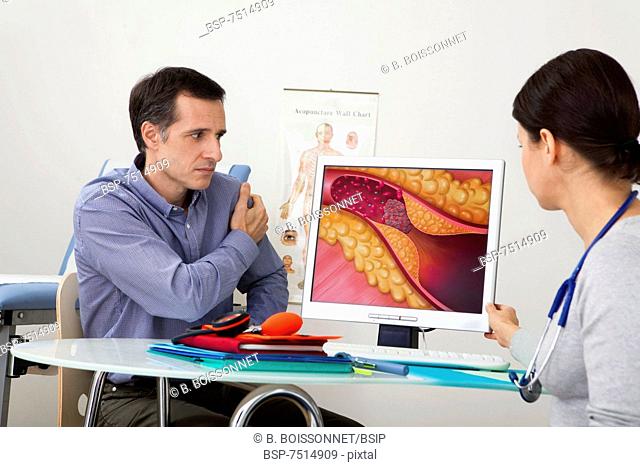 CARDIOLOGY CONSULTATION MAN Models. On screen, drawing representing an artery obstructed by a thrombus caused by a plaque of atheroma