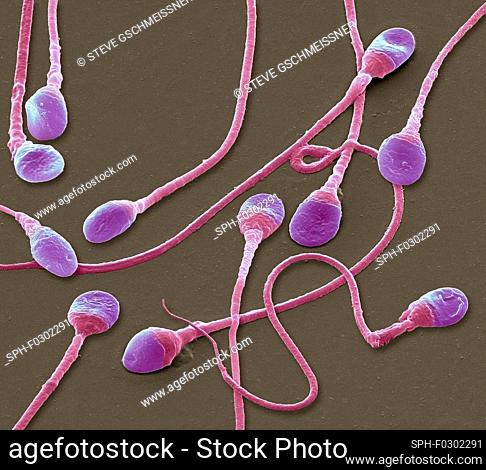 Sperm cells. Coloured scanning electron micrograph (SEM) of human sperm cells or spermatozoa. These tiny male sex cells are produced in the testes