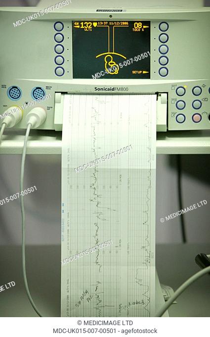 A Computerised ECG machine monitoring the baby's heart beat