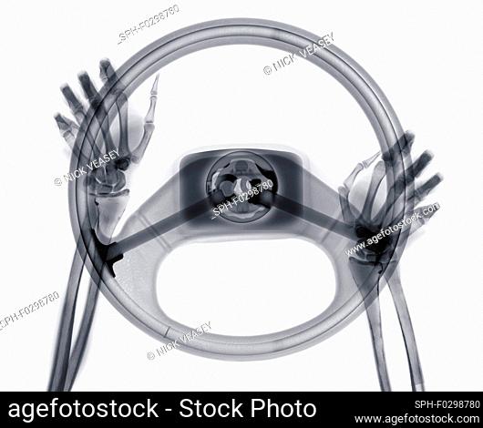 Human hands on steering wheel, X-ray