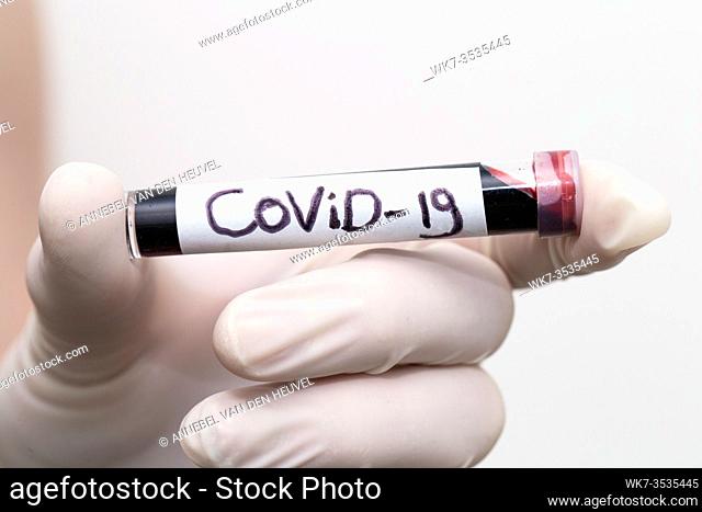Convid-19 blood sample, doctor wearing medical gloves holding a blood tube with positive Coronavirus 2019-nCoV Blood Sample. macro