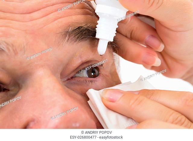 Close-up Of An Optometrist's Hand Putting Eye Drops In Senior Patient's Eye