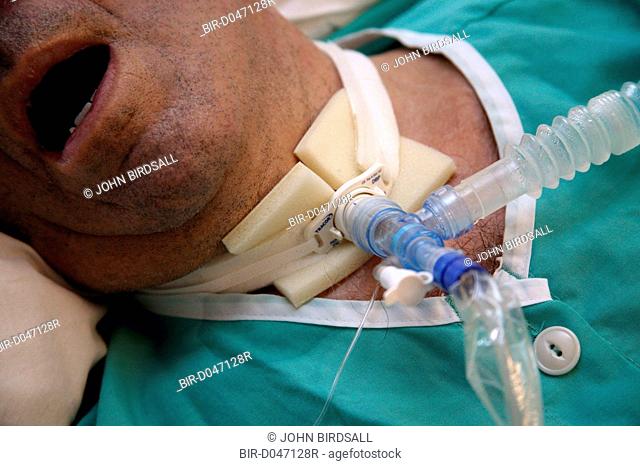 Patient who has undergone a Tracheostomy on the High Dependency Unit