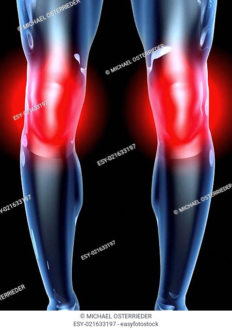 Knee Ache - Anatomy