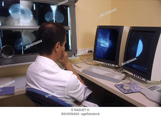 DOCTOR IN HOSPITAL<BR>Photo essay from hospital.<BR>Digital mammography.   Mammography unit of the Gustave Roussy Institute