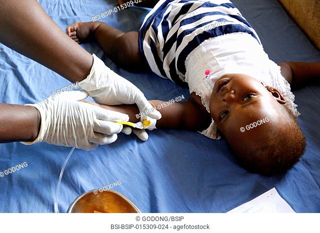 Bweyale medical center. Child suffering from malaria
