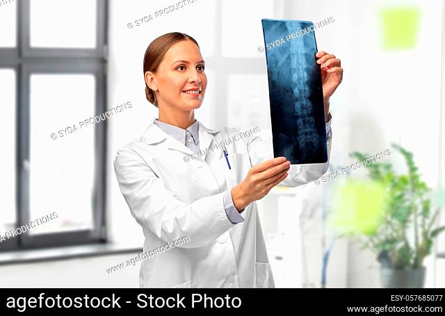 female doctor with x-ray of spine at hospital
