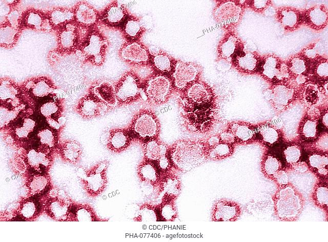 Electron micrograph of the La Crosse virus LCV, a RNA Bunyaviridus responsible for La Crosse encephalitis