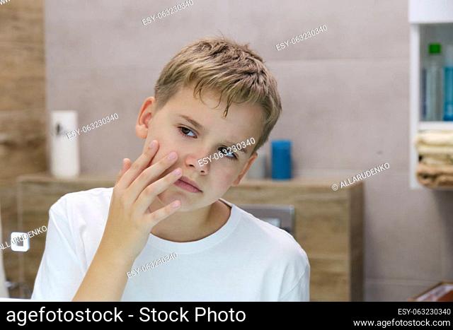Reflection of a teenager irritated by dry unhealthy skin, worried about problems with his face. Unhappy teenage boy touching his cheek
