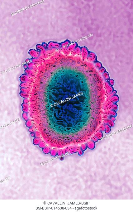 Human coronavirus. Human coronavirus causes respiratory infections and gastroenteritis. Image produced using high-dynamic-range imaging (HDRI) from an image...
