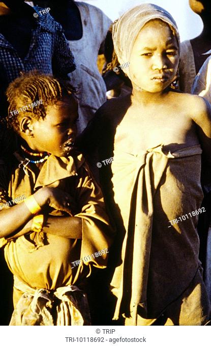 Tandelti Camp Sudan Children Suffering From Kwashikor & Scabies