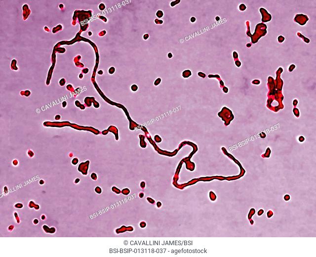 Haemophilus influenzae Pfeiffer's bacillus. Its unencapsulated strain is responsible for local infections : ear infections, sinusitis, pharyngitis