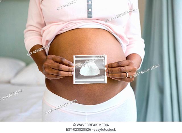 Pregnant woman holding ultrasound scan