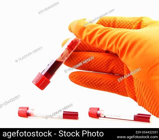 Coronavirus disease (COVID-19) research. Blood test. Regular blood testing is one of the most important ways to keep track of your overall physical well-being