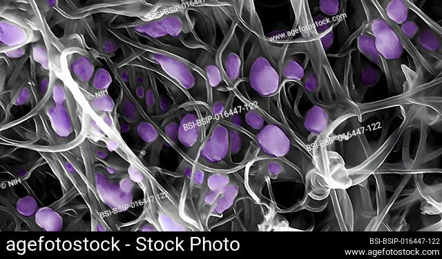 The purple pods you see in this scanning electron micrograph are the H5N2 avian influenza virus, an averted threat to the poultry and egg industry and