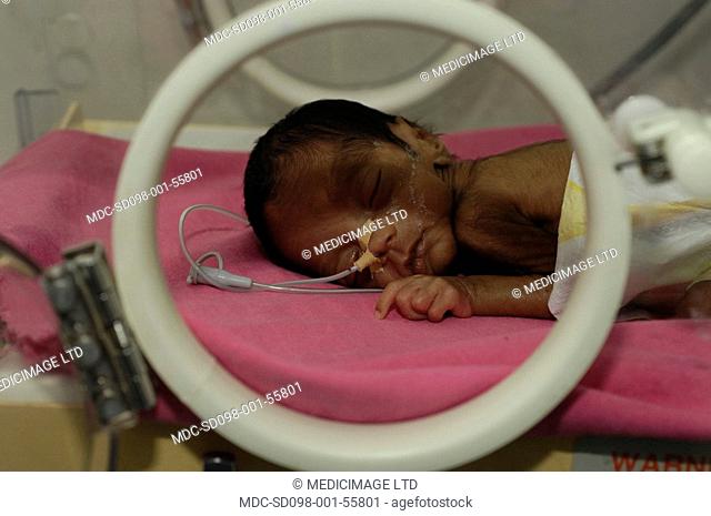 Premature baby in an incubator in the neonatal unit of a hospital. Premature babies are placed in incubator as they have not fully developed the mechanisms for...