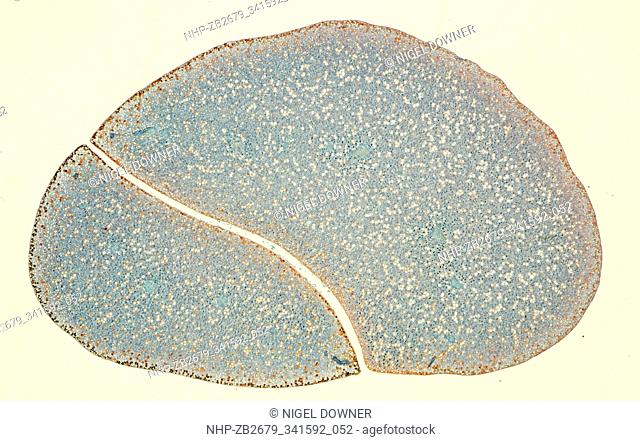 Light micrograph cross section through the fruit of a Loquat tree (Eriobotrya japonica), UK. This evergreen tree of shrub is also known as Japanese medlar or...