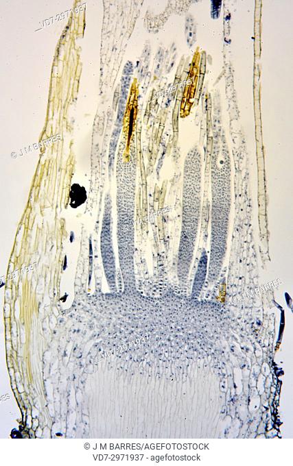 Moss archegonium. Optical microscope X100