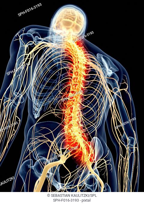 Human spinal nerve pain
