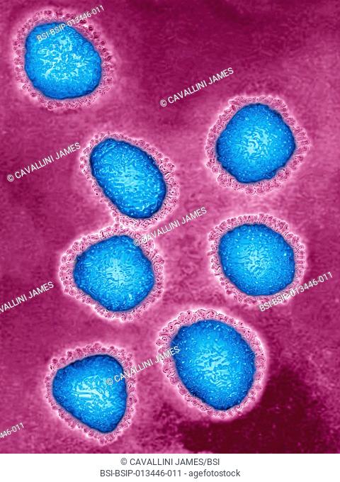 Coronavirus. Image produced using high-dynamic-range imaging (HDRI) from an image taken with transmission electron microscopy