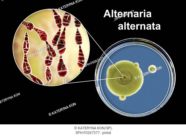 Filamentous allergenic fungus Alternaria alternata, computer illustration of fungal morphology and photograph of fungal colonies on Sabouraud Dextrose Agar