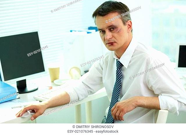 Businessman with bruise