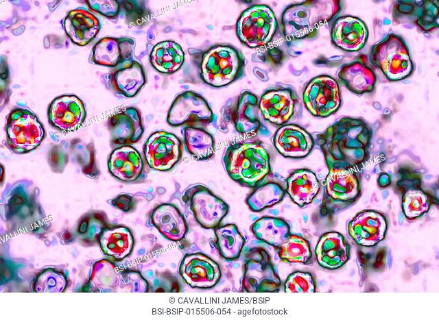 The measles virus (paramyxoviridae from the Morbillivirus family). Image taken from a transmission microscopy view