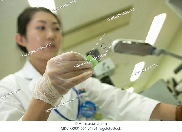 A microscopic slide has been prepared for patient blood analysis./nA patients blood is investigated to determine blood type A, B, O, the Rhesus-D-factor and