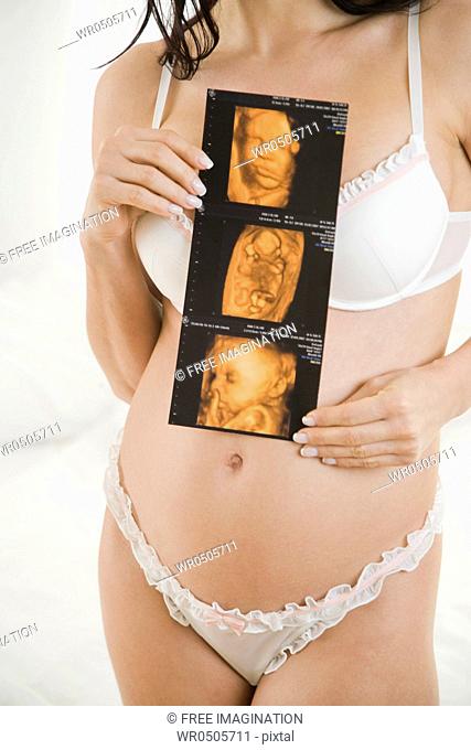 pregnant woman with sonogram