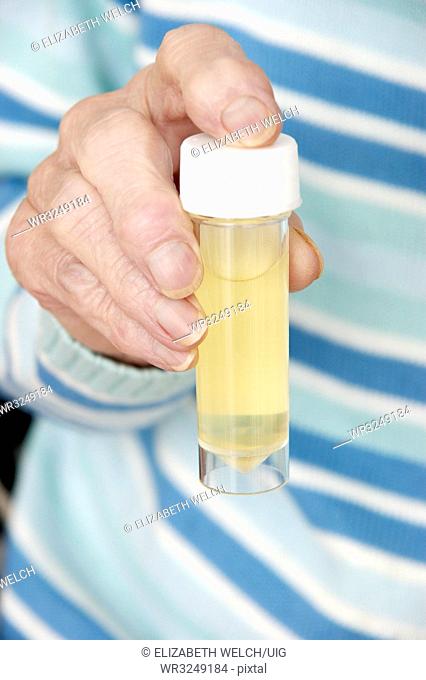 Elderly woman with a sterile universal container with a urine specimen ready for analysis