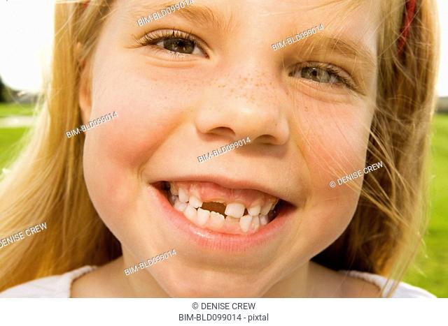 Grinning girl with tooth missing