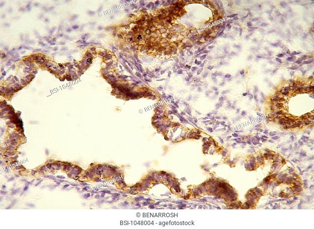FETAL LUNG,  HISTOLOGY<BR>Histological section of a human fetal lung at the stage of 14 weeks of gestation.  Staining with an anti cytokeratin 7 antibody