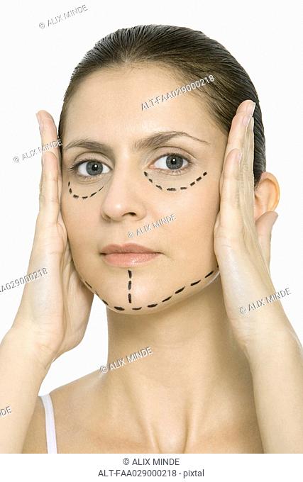 Woman with plastic surgery markings on face, holding face in hands, looking at camera