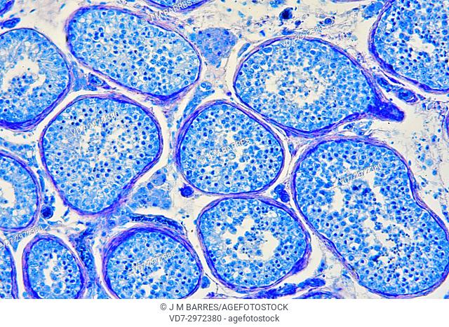 Human testicle or testis section showing seminiferous tubules, Leydig cells, Sertoli cells, spermatocytes and spermatogonia. Optical microscope X200